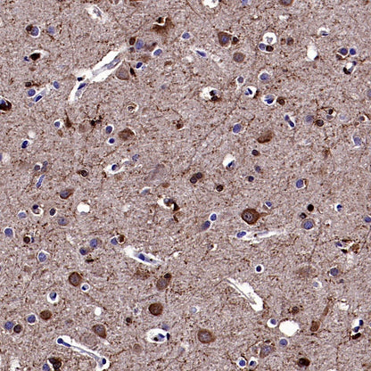 Gelsolin Recombinant Rabbit mAb (S-2522-21)