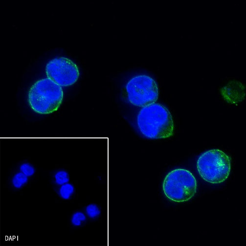 HLA-DPB1 Recombinant Rabbit mAb (S-R263)
