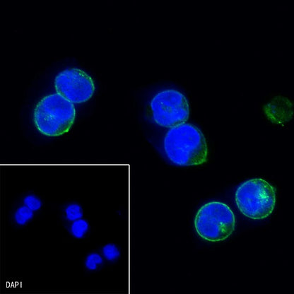 HLA-DPB1 Recombinant Rabbit mAb (S-R263)