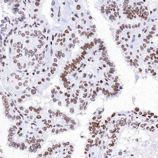 Histone H3 (acetyl K23) Recombinant Rabbit mAb (S-3321-202)