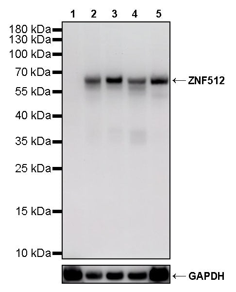 ZNF512 Recombinant Rabbit mAb (S-4182-60)
