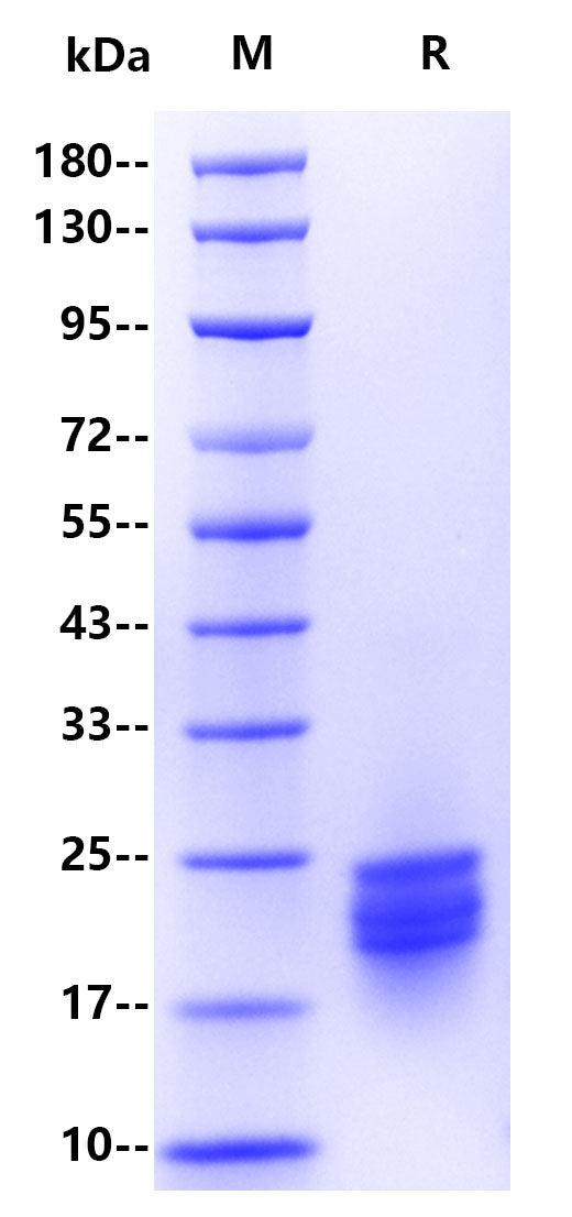 IFN-α2 His Tag Protein, Human
