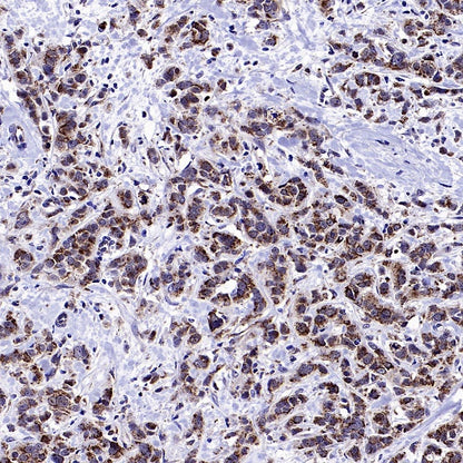 GPD2 Recombinant Rabbit mAb (S-2941-41)
