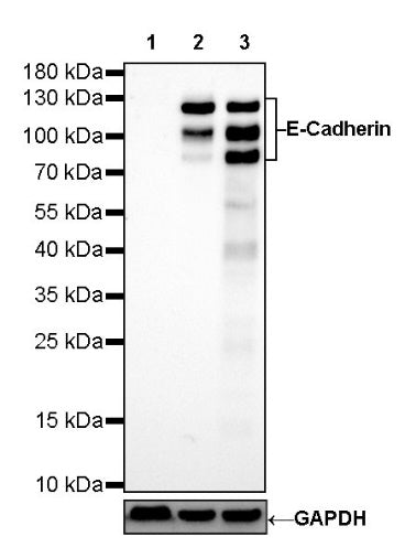 E-Cadherin Recombinant Rabbit mAb (SDT-438-45)