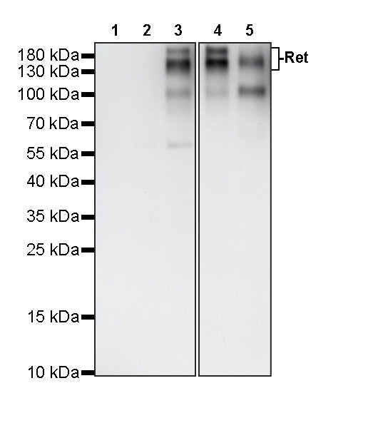 Ret Recombinant Rabbit mAb (S-4326-45)