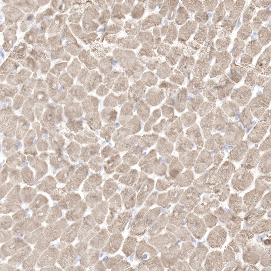 Myoglobin Recombinant Rabbit mAb (SDT-097-10)