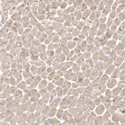 Myoglobin Recombinant Rabbit mAb (SDT-097-10)