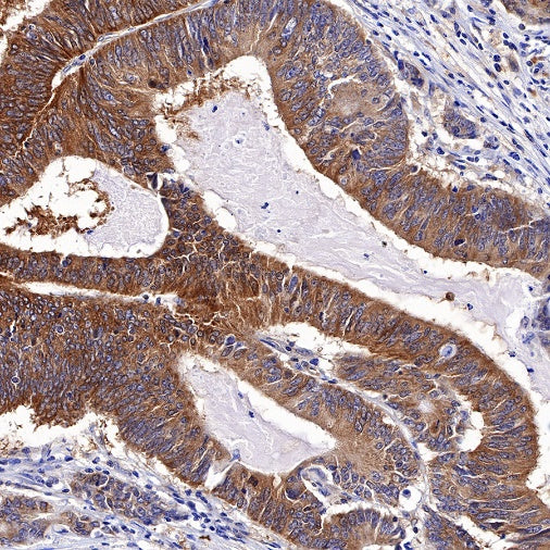 Bad Recombinant Rabbit mAb (S-976-26)