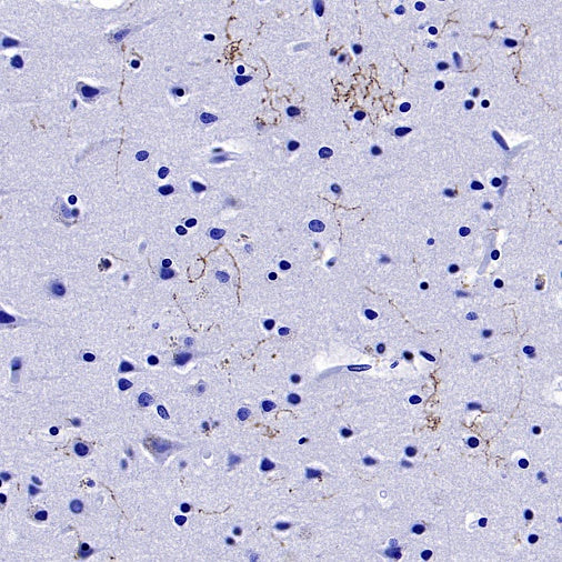 5-HT (Serotonin) Transporter Recombinant Rabbit mAb (S-1332-21)