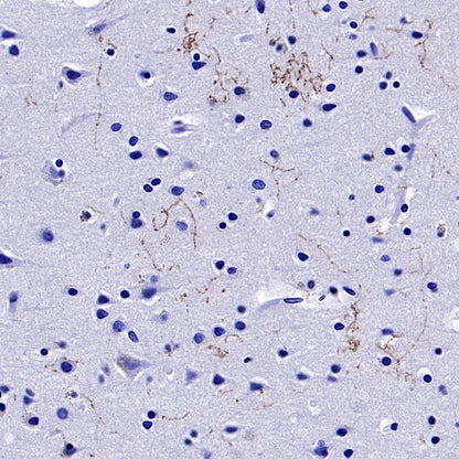 5-HT (Serotonin) Transporter Recombinant Rabbit mAb (S-1332-21)