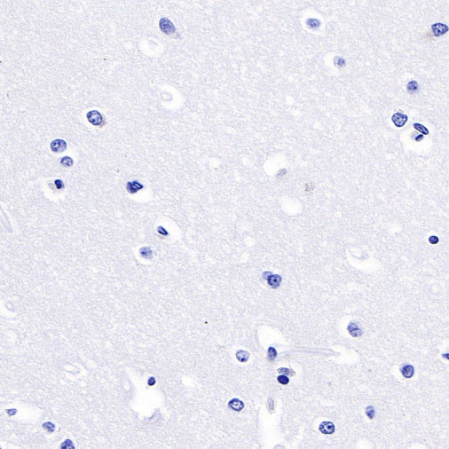 Luteinizing Hormone Beta Recombinant Rabbit mAb (SDT-545-2)