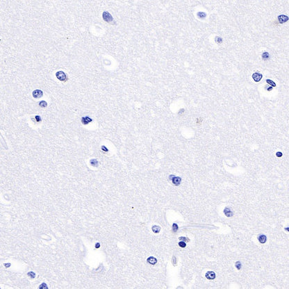 Luteinizing Hormone Beta Recombinant Rabbit mAb (SDT-545-2)