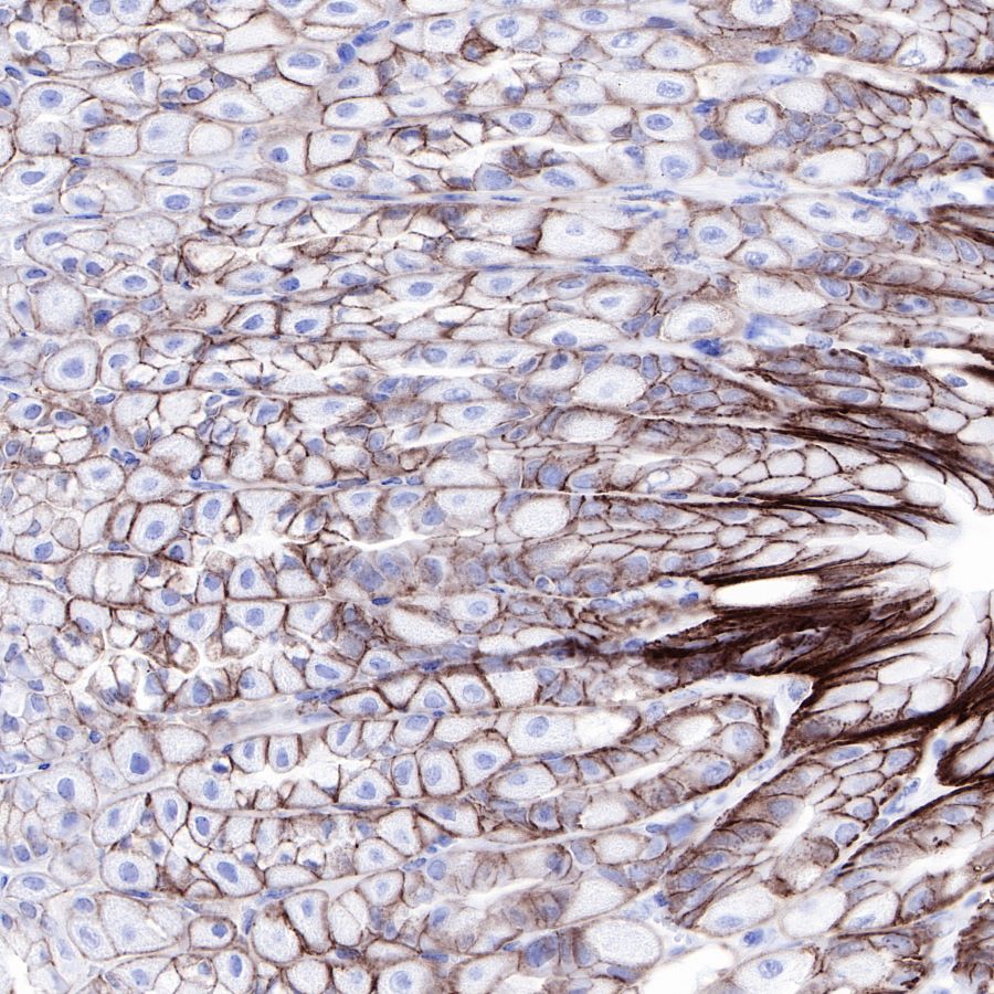 Claudin18.2 Recombinant Rabbit mAb,PBS Only (SDT-102-24)