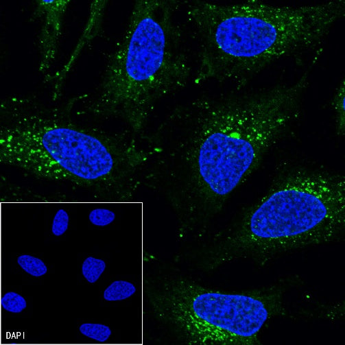 LAMP1 Recombinant Rabbit mAb (Alexa Fluor® 488 Conjugate) (SDT-405-39)