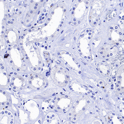 Glypican-3 Recombinant Rabbit mAb (SDT-4064-69-2)