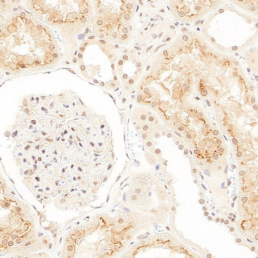 SMN2 Recombinant Rabbit mAb (S-4920-4)