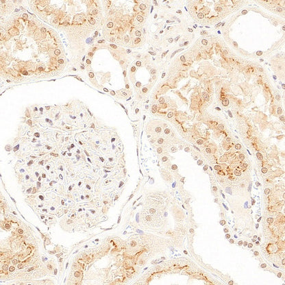 SMN2 Recombinant Rabbit mAb (S-4920-4)