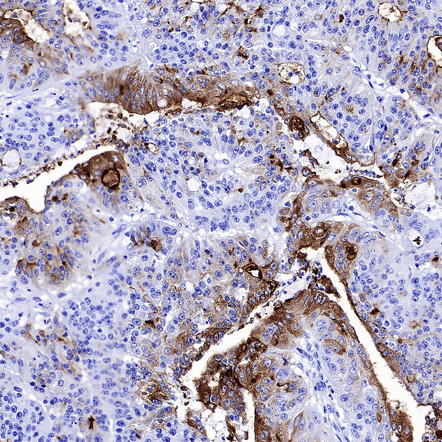 MUC17 Recombinant Rabbit mAb (SDT-3951-56)