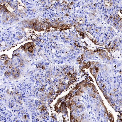 MUC17 Recombinant Rabbit mAb (SDT-3951-56)