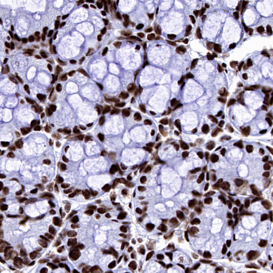 DDX39B Recombinant Rabbit mAb (S-4549-30)