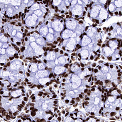 DDX39B Recombinant Rabbit mAb (S-4549-30)