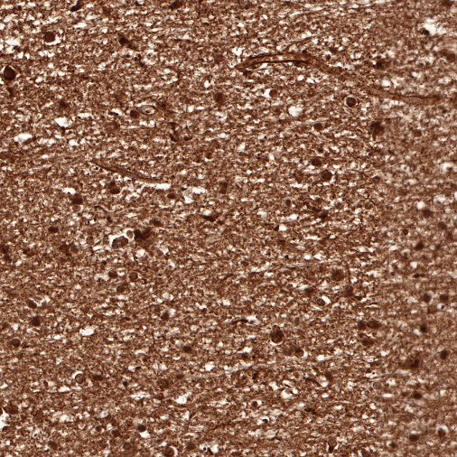 S-RMab® S100B Recombinant Rabbit mAb (SDT-518-45)