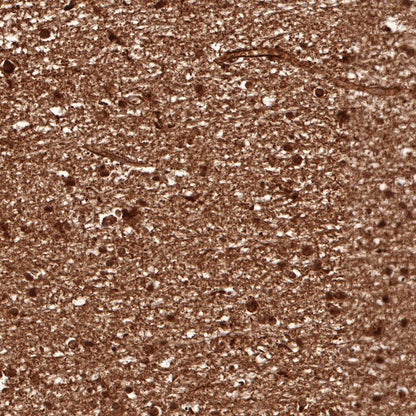 S-RMab® S100B Recombinant Rabbit mAb (SDT-518-45)