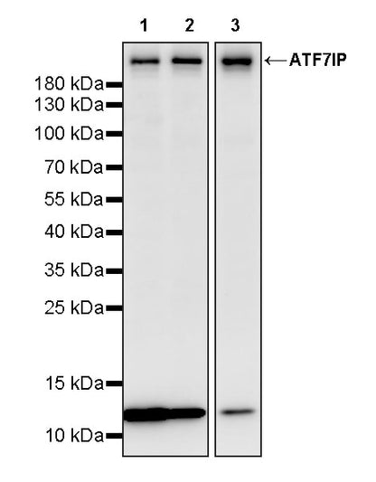 ATF7IP Recombinant Rabbit mAb (S-4081-25)