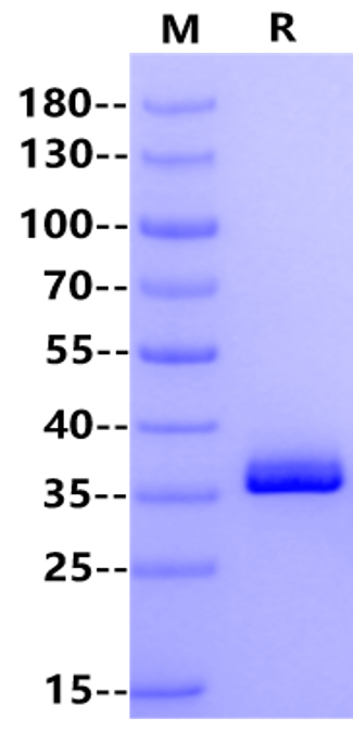 IGFBP-1 Protein, Mouse