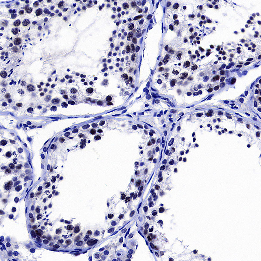 CDK7 Recombinant Rabbit mAb (S-2739-124)