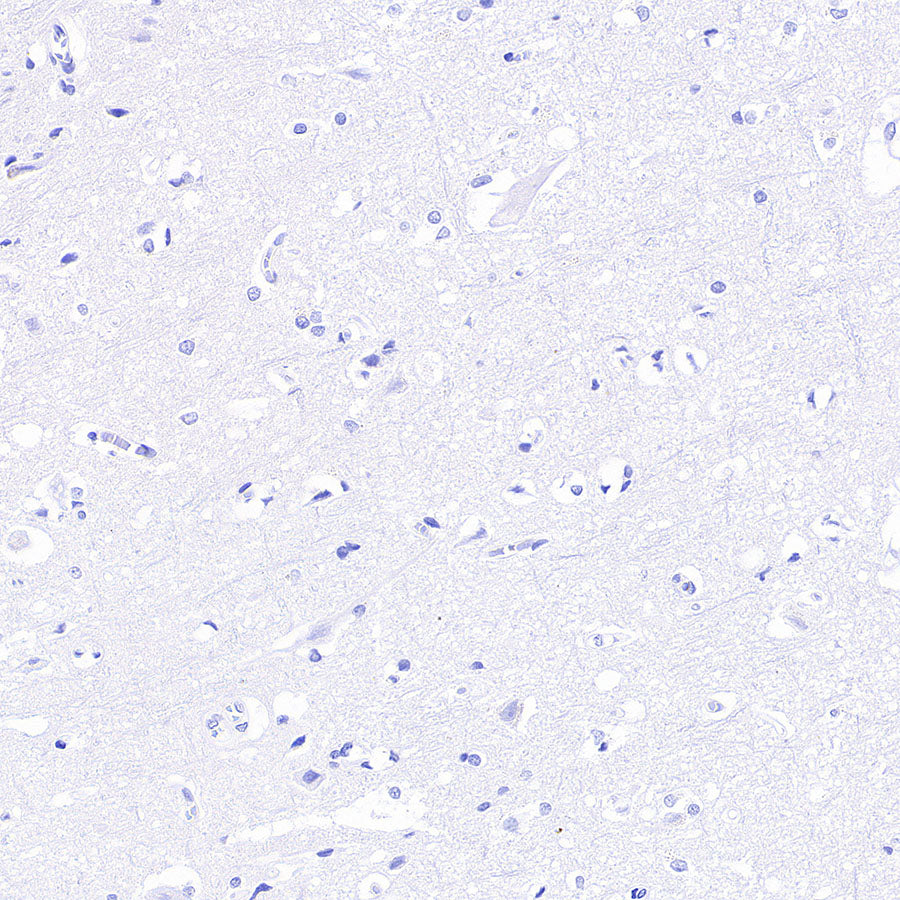 groEL Recombinant Rabbit mAb (S-4634-25)