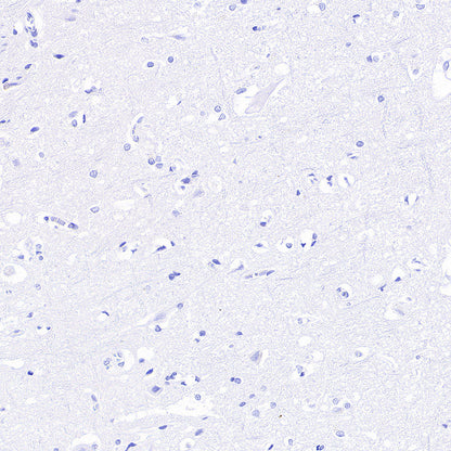 groEL Recombinant Rabbit mAb (S-4634-25)