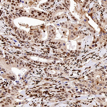 SAMHD1 Recombinant Rabbit mAb (S-2401-25)