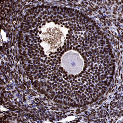 FOXL2 Recombinant Rabbit mAb (SDT-557-361)