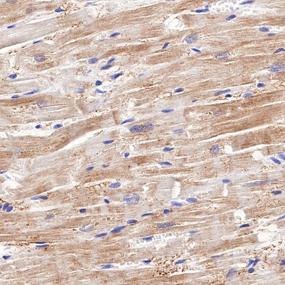 NDRG2 Recombinant Rabbit mAb (S-618-76)