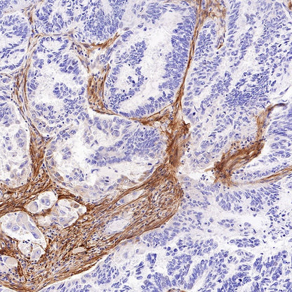 LRRC15 Recombinant Rabbit mAb (S-2473-43)