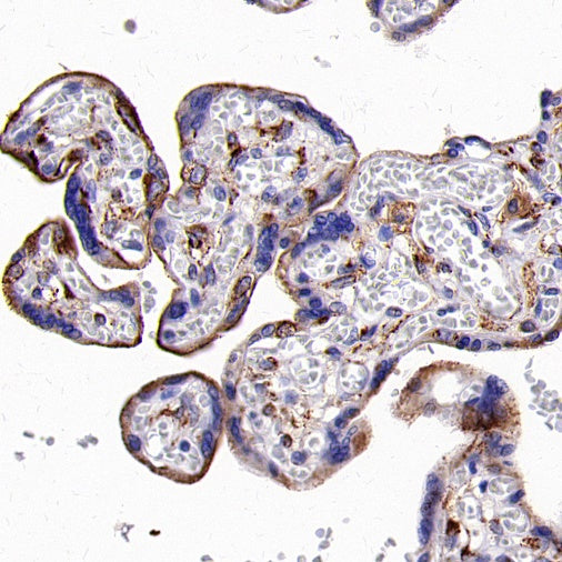 LRP1 Rabbit Polyclonal Antibody