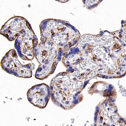 LRP1 Rabbit Polyclonal Antibody