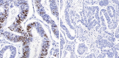 Phospho-gamma H2A.X (Ser139) Recombinant Rabbit mAb (S-981-56)