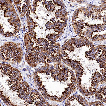 Napsin A Recombinant Rabbit mAb (SDT-2777-115)