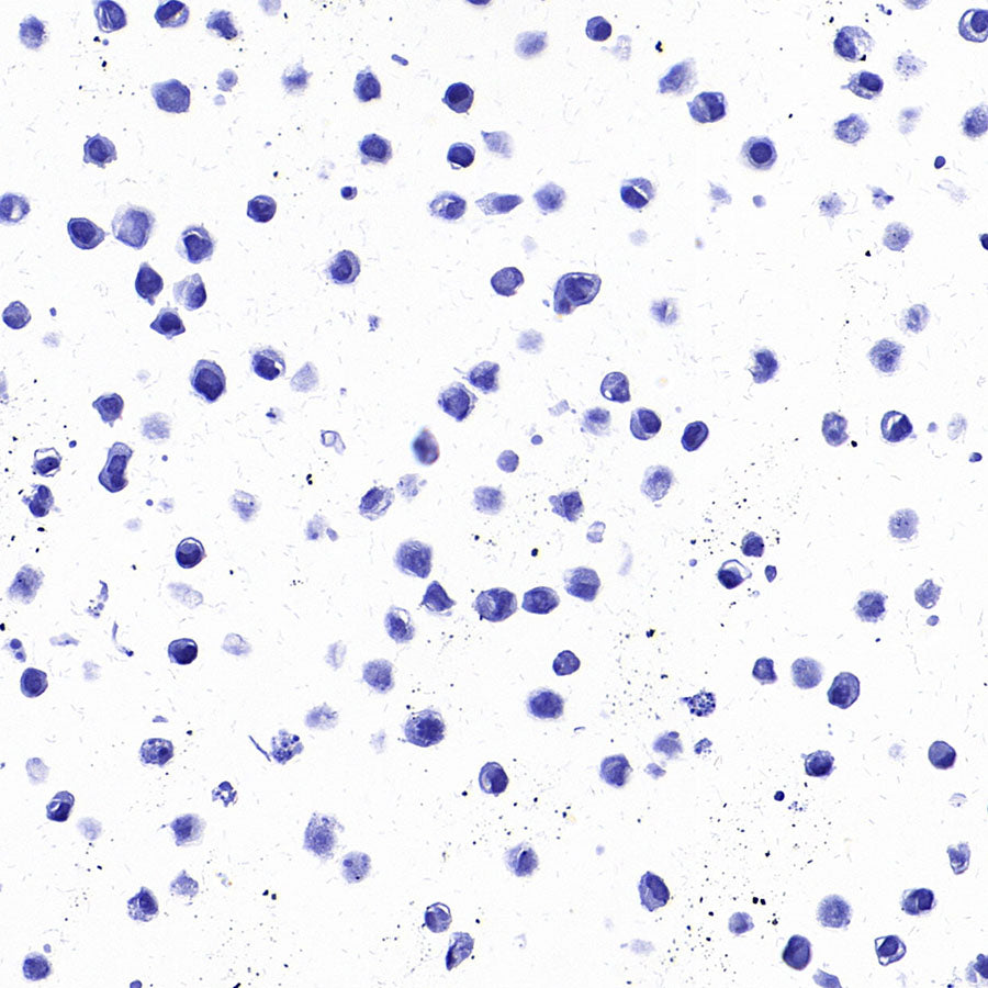 STEAP1 Recombinant Rabbit mAb (S-3613-107)