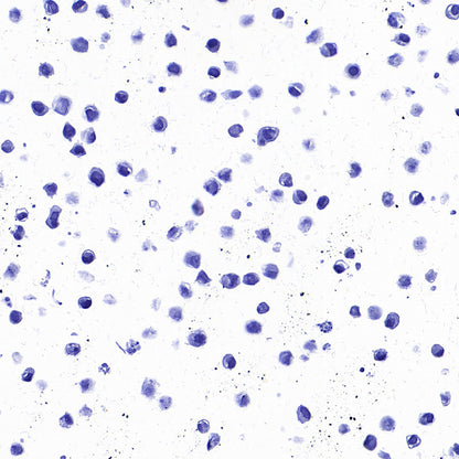 STEAP1 Recombinant Rabbit mAb (S-3613-107)