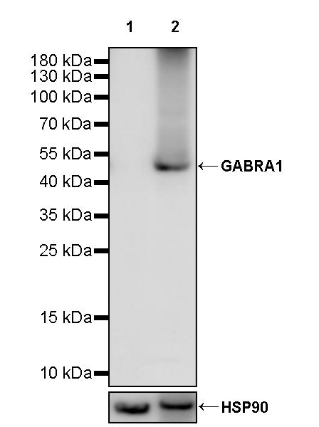 GABRA1 Recombinant Rabbit mAb (S-3254-10)