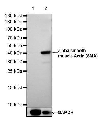 alpha smooth muscle Actin (SMA) Recombinant Rabbit mAb,PBS Only (SDT-132-63)