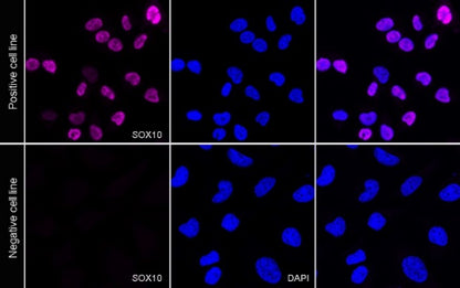 SOX10 Recombinant Rabbit mAb (Alexa Fluor® 647 Conjugate) (SDT-R233)