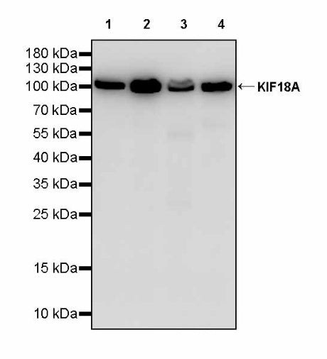 KIF18A Recombinant Rabbit mAb (S-3310-11)