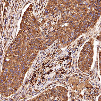 GRP94 Recombinant Rabbit mAb (S-R268)