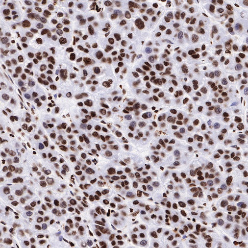 Histone H2B Recombinant Rabbit mAb (S-R214)