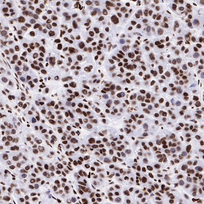 Histone H2B Recombinant Rabbit mAb (S-R214)