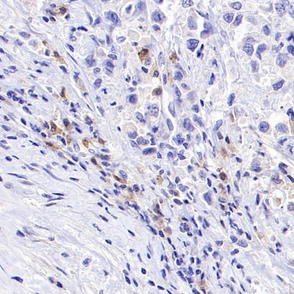 TNFRSF17/BCMA Recombinant Rabbit mAb (S-4674)